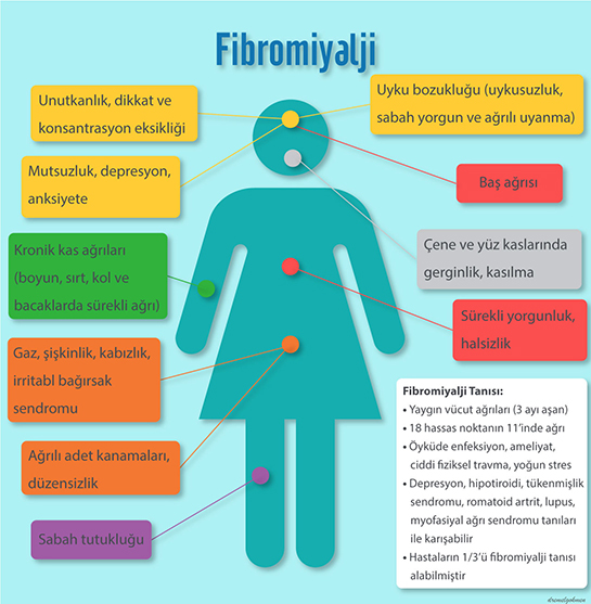 Fibromiyalji Belirtileri Nelerdir?