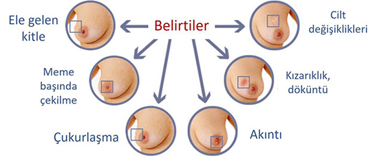 Gs Kanseri Belirtileri