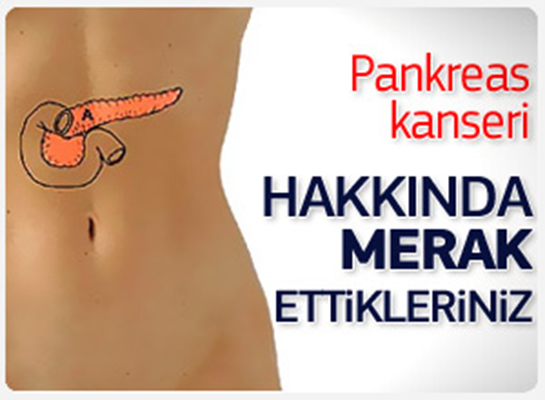 Pankreas Kanseri Belirtileri